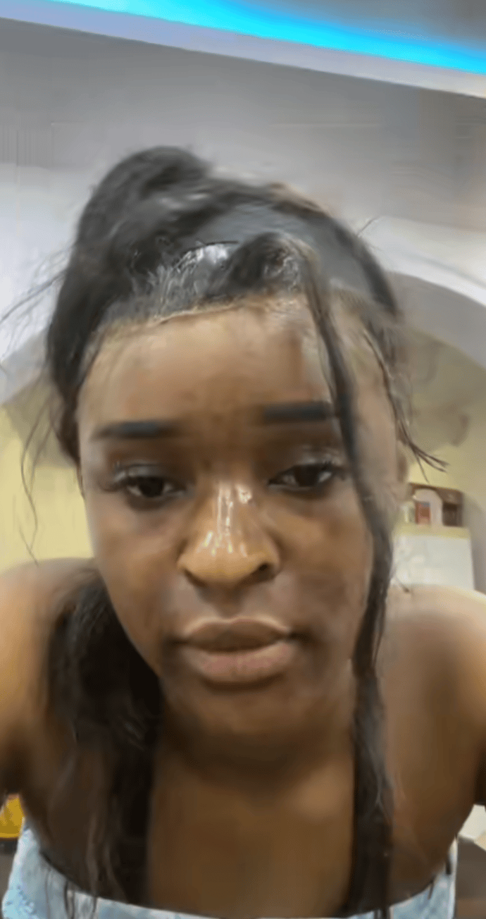 “I don’t deserve this” – Lady cries out as house help mixes substance in her face cream to burn her skin (Video)
