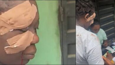 2023 Elections: Lagosian casts vote despite bloodied face (Video)