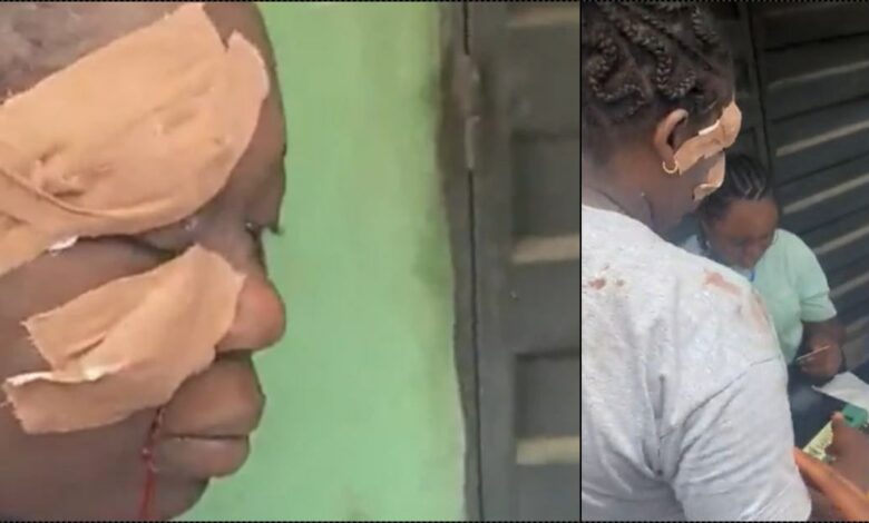 2023 Elections: Lagosian casts vote despite bloodied face (Video)
