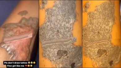 "Please don't draw tattoo" — Lady pleads as she shares painful experience (Video)