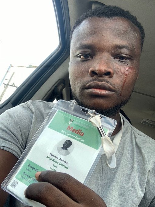 Journalist injured by thugs at Elegushi Palace 