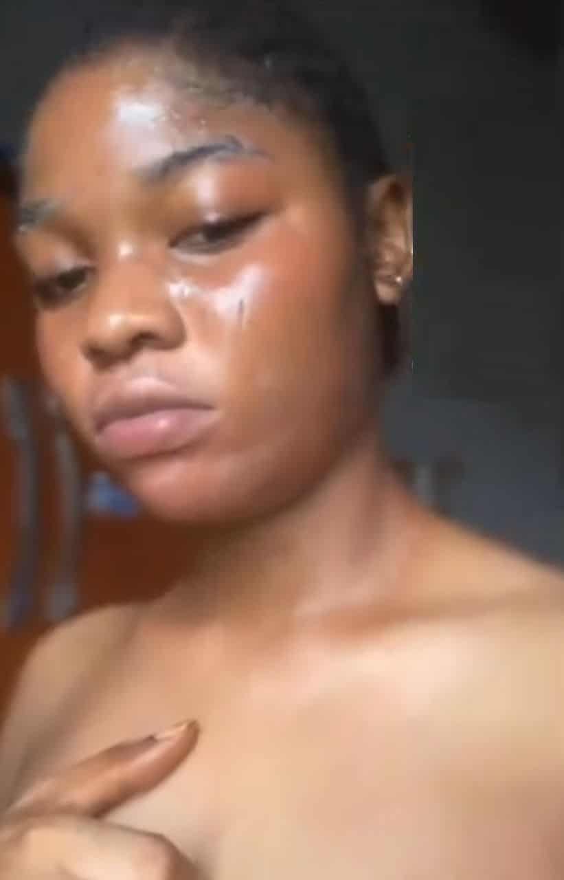 "I use it everyday" — Lady cries out over side effect of contraceptive pills on her skin