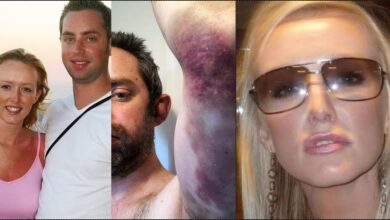 "I wear makeup to cover bruises" — Man opens up after 20 years of domestic abuse from wife