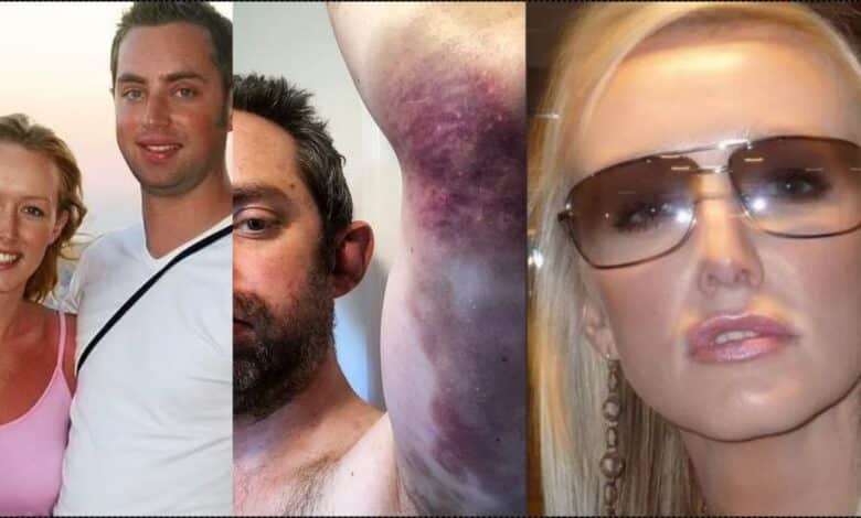 "I wear makeup to cover bruises" — Man opens up after 20 years of domestic abuse from wife