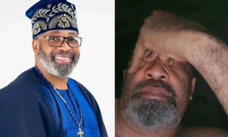 Yemi Solade battling depression
