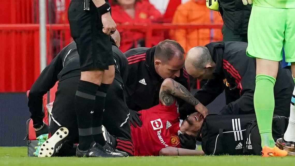 Antony and Luke Shaw injured ahead of FA Cup final against Manchester City