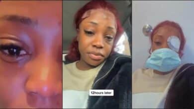 Lady almost loses an eye after attaching eyelash extension (Video)