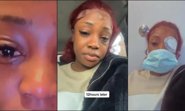 Lady almost loses an eye after attaching eyelash extension (Video)