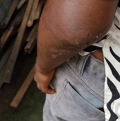 Woman arrested for brutally assaulting her son in Rivers