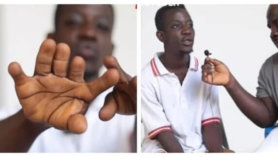 Video of Ghanaian man with 12 fingers and both sex organs causes stir online