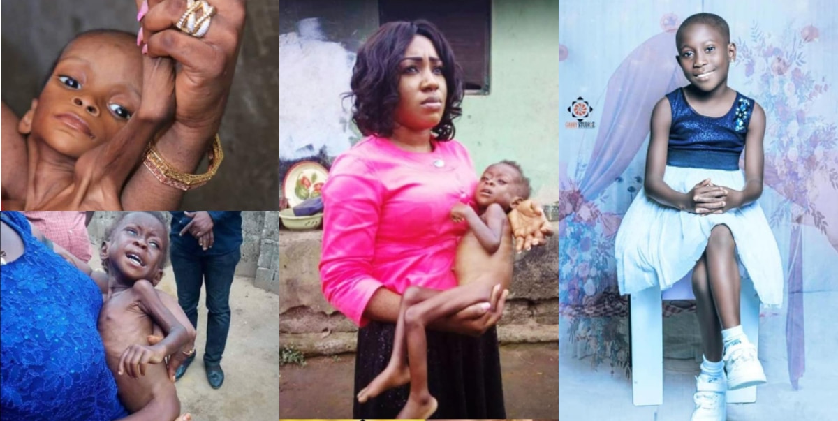 Transformation photos of severely malnourished girl rescued in cross river 6 years ago