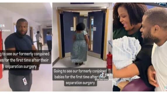 Parents of conjoined twins see their twin babies for the first time after separation surgery (Video)