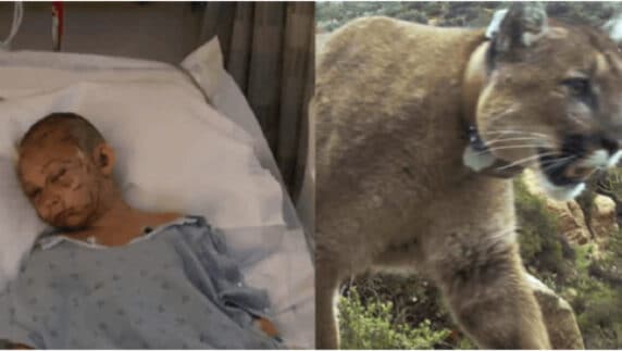9-year-old girl survives terrifying cougar attack while playing hide and seek