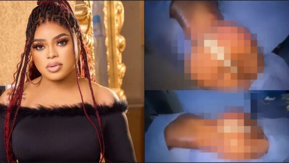 "I pray all these bruises clear" — Bobrisky shares post-surgery scars (Video)