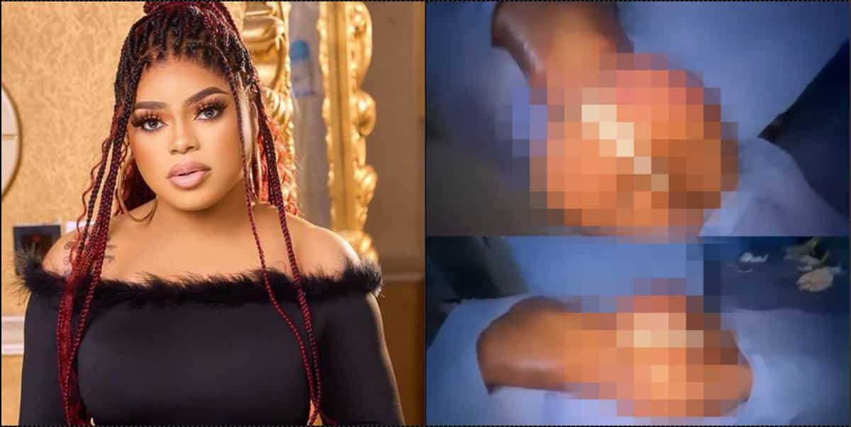 "I pray all these bruises clear" — Bobrisky shares post-surgery scars (Video)