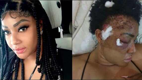 Angela Okorie calls out friend for sending video of her in pain to blogger