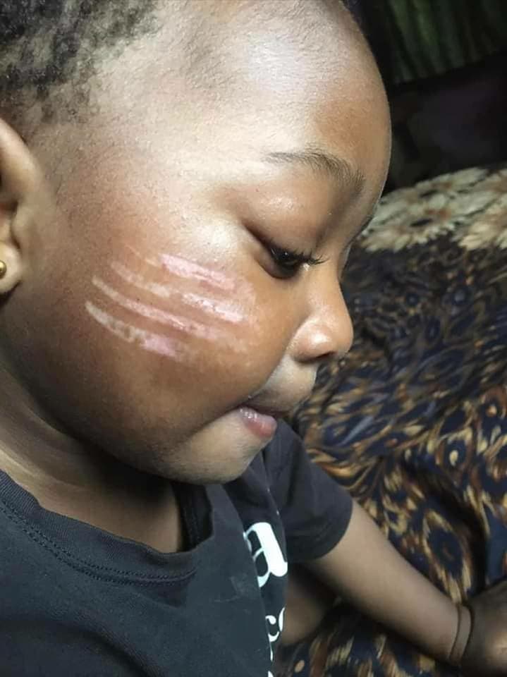 Mother angry as daycare teacher gives child four long tribal mark on cheeks