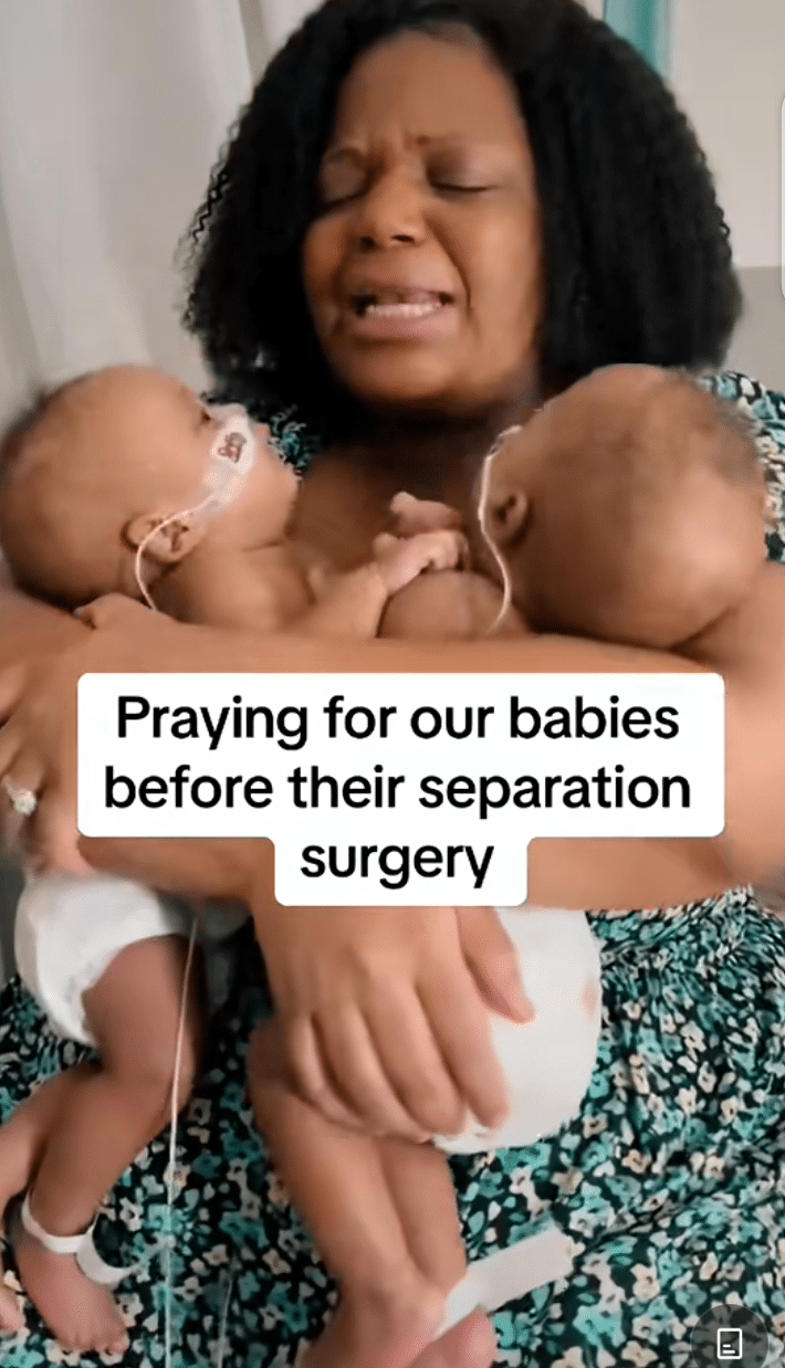 Mother prays to God over conjoined babies 