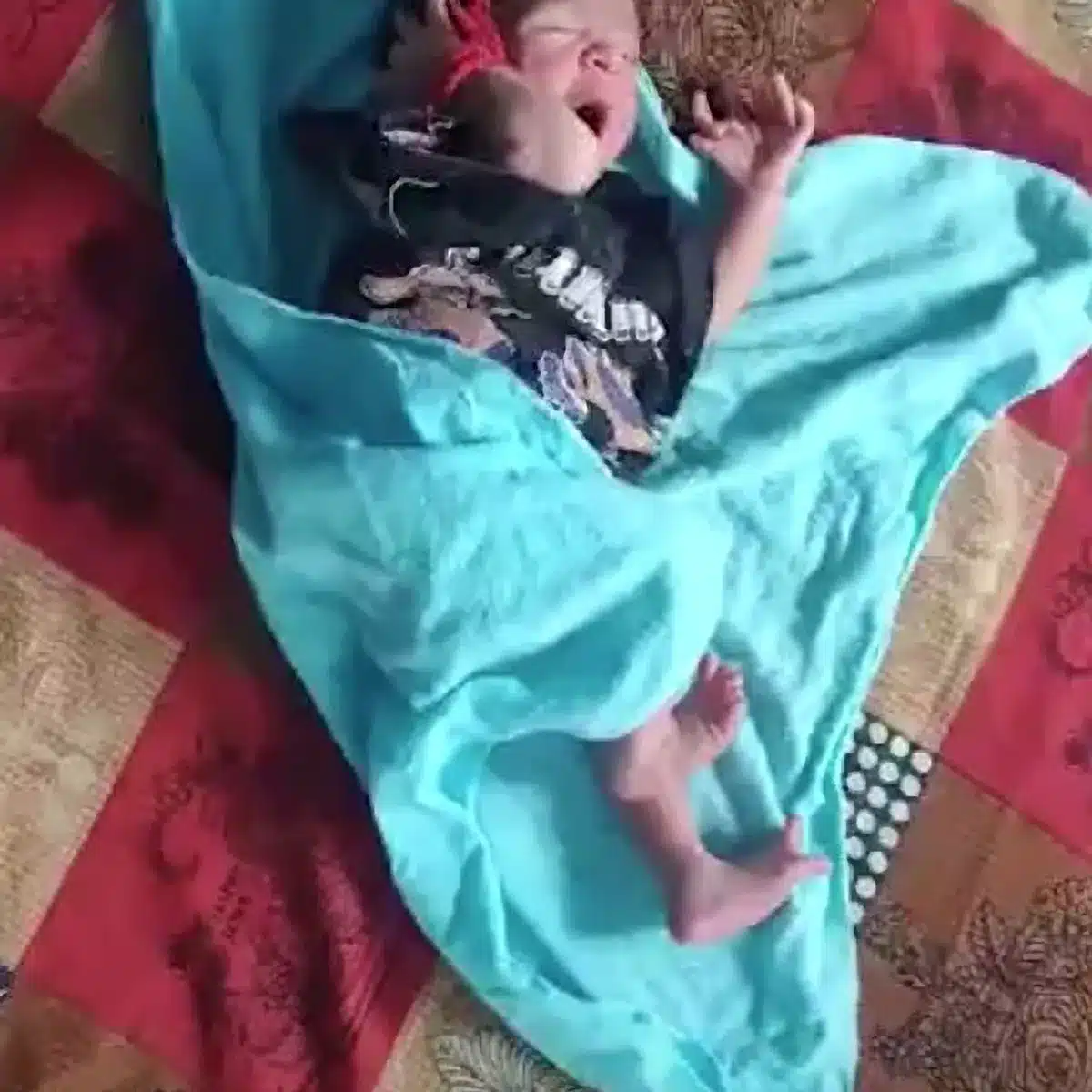 Baby born with 26 fingers, family calls her incarnation of goddess