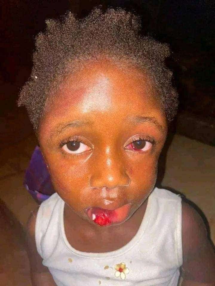 Woman beats 5-year-old girl mercilessly for taking food from her pot to eat