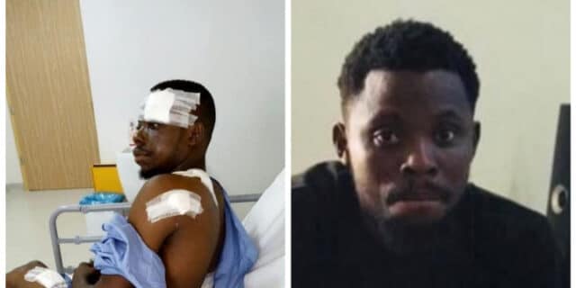 "9 bullets, 3 surgeries" ― Nigerian man marks seven years since he survived brutal armed robbery attack