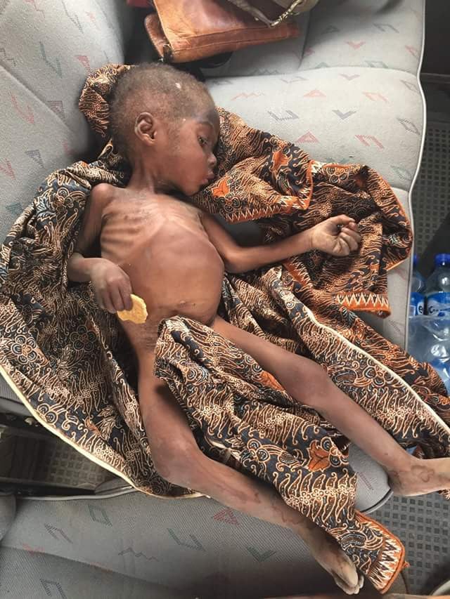 Boy rescued in Akwa-Ibom reunites with mother 7 years after branded a wizard, left to starve