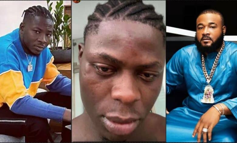 Dre DMW calls out Sam Larry, shares wounded face of late Mohbad