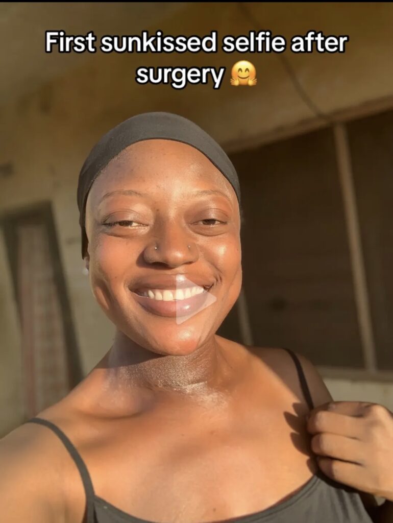 Thyroid survivor explains her journey with the disease