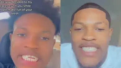 Nigerian man reveals how well braces transformed his looks