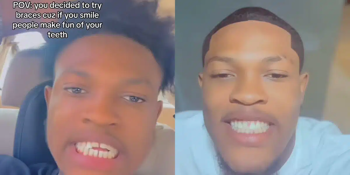 Nigerian man reveals how well braces transformed his looks