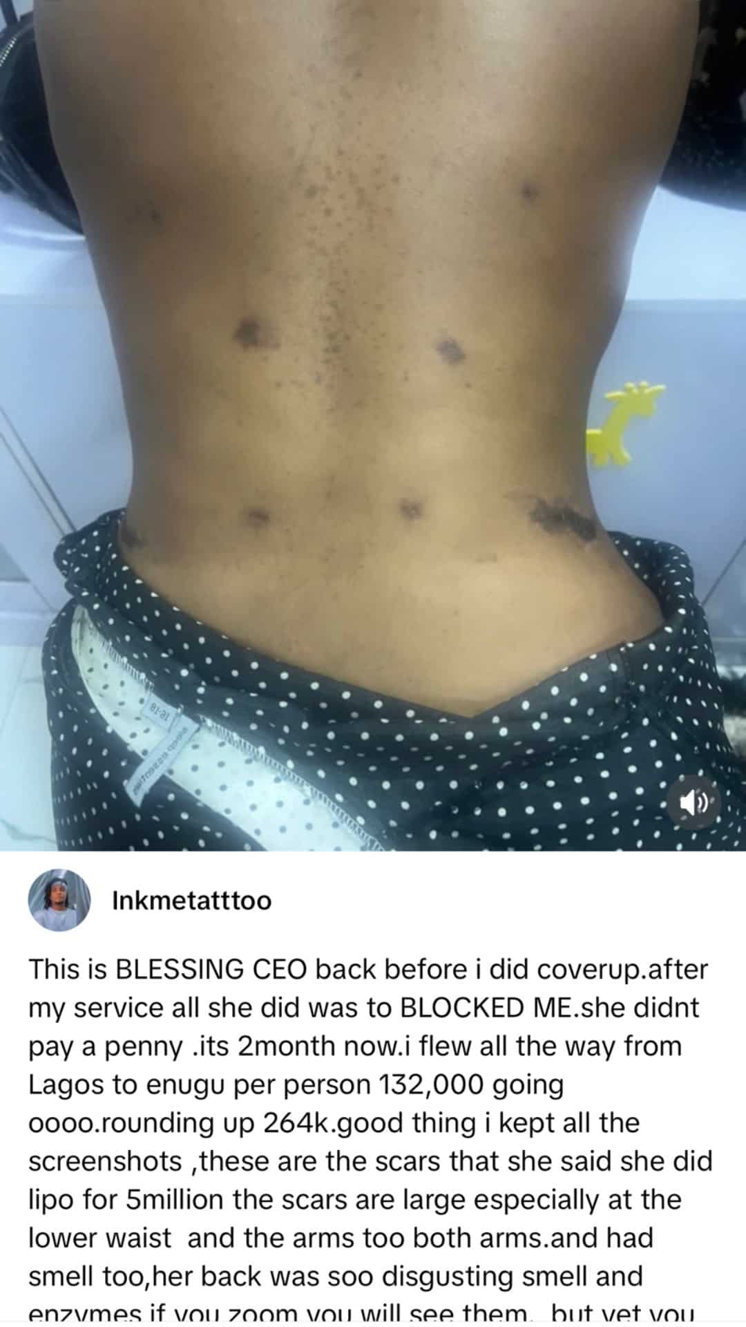 Tattoo artist calls out Blessing CEO for refusing to pay after covering surgery scars