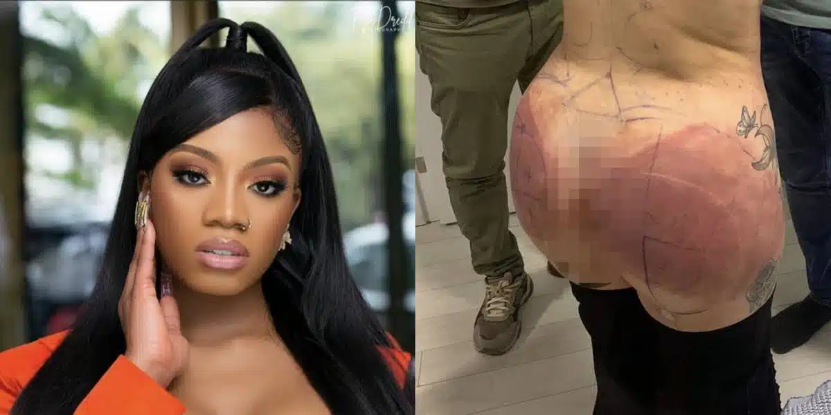 “Do your research before getting plastic surgery” — Angel advises women