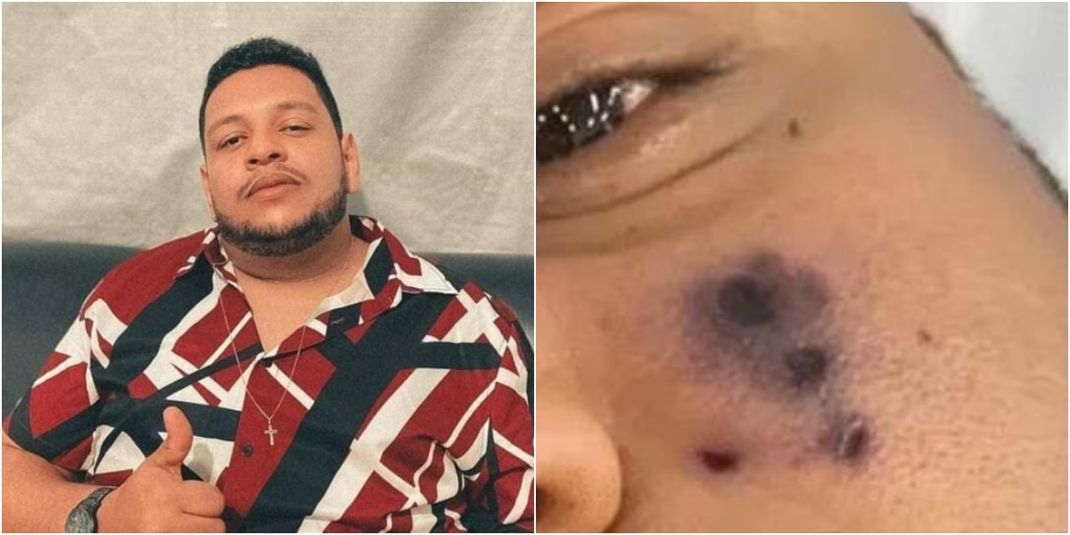 Singer Darlyn Morais dies at 28 after being bitten by a Spider