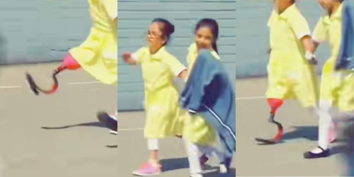 Little girl school prosthetic leg friends