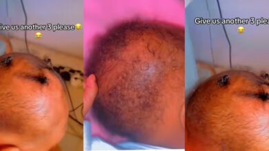 "Put it in rice" - Lady causes laughter, advises mother to put daughter's head in rice because her hair refuses to grow