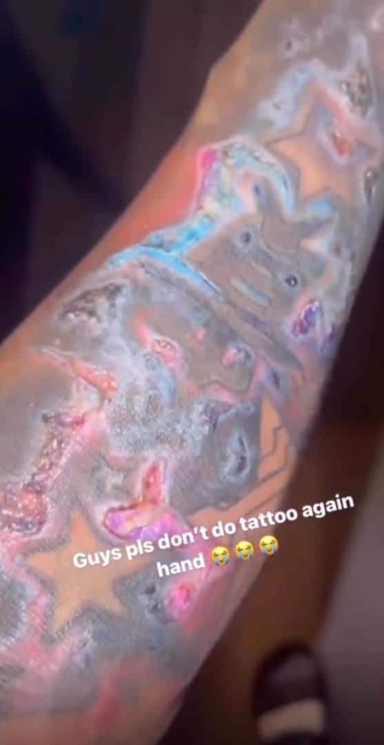 "Please don't do tattoo" - Man pleads after suffering severe skin reaction