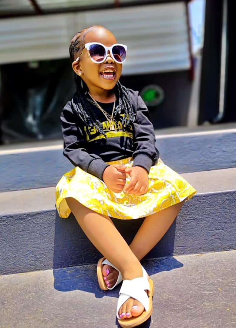 "No operation was done" - Transformation of baby born with a medical condition melts hearts