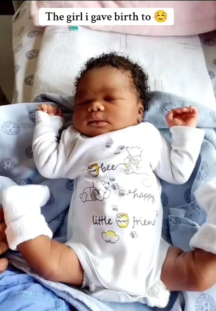 "No operation was done" - Transformation of baby born with a medical condition melts hearts