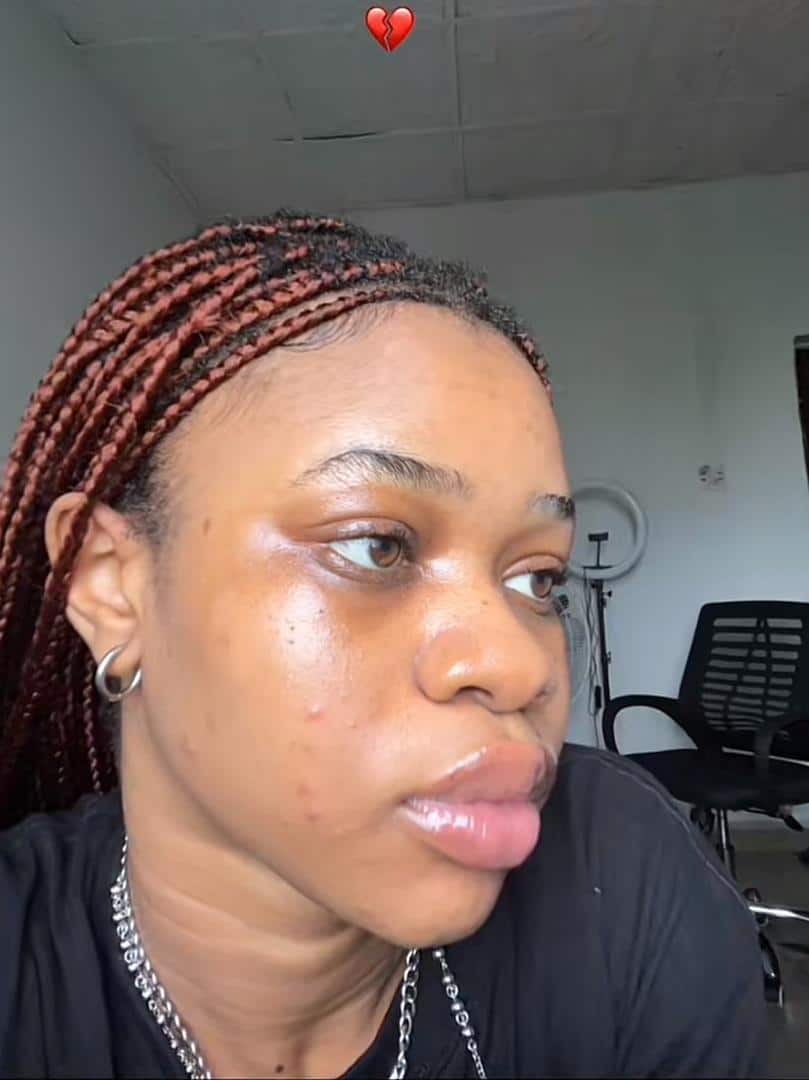 Lady warns against joining skincare routine trend as her skin goes from good to bad