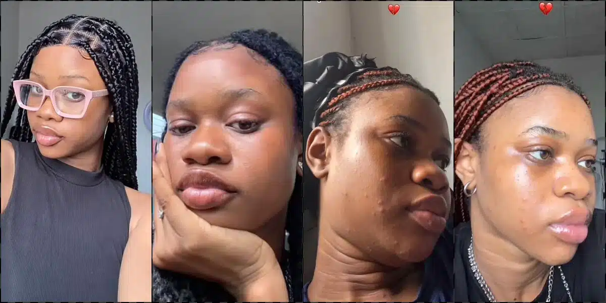Lady warns against joining skincare routine trend as her skin goes from good to bad