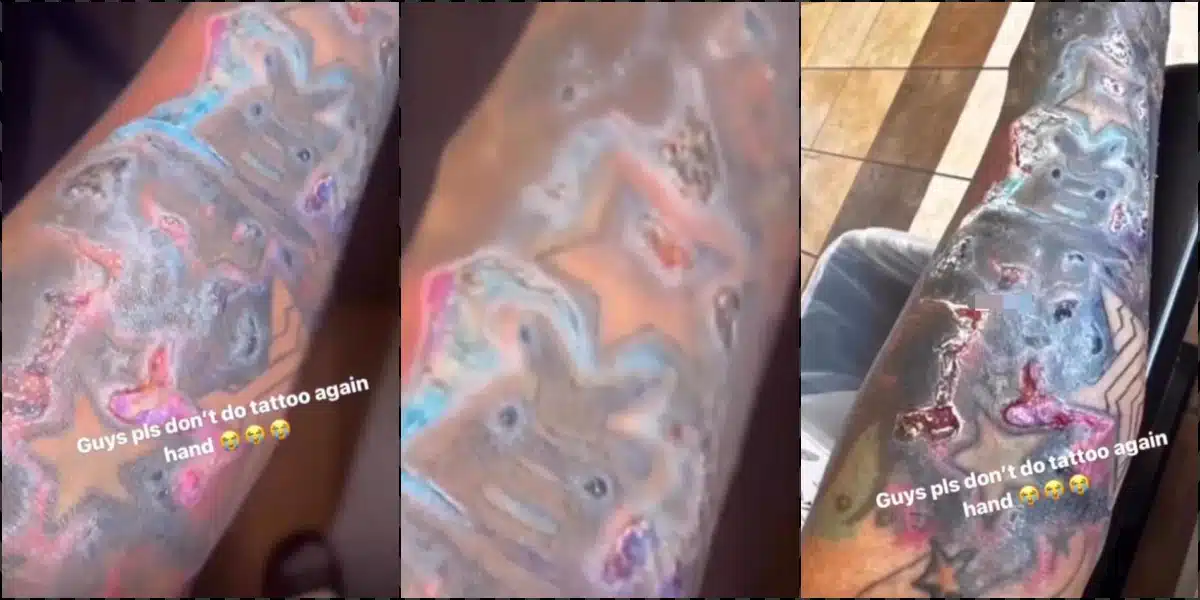 "Please don't do tattoo" - Man pleads after suffering severe skin reaction