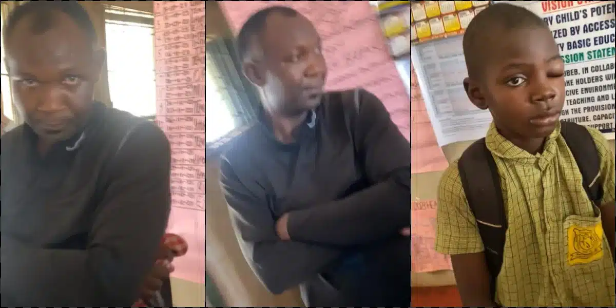 Mother fumes as teacher leaves 9 year-old student with swollen eye