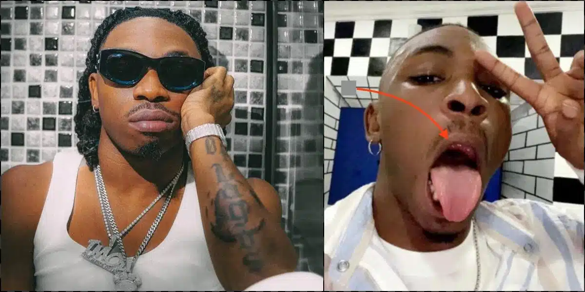 Mayorkun recounts how a fan broke his tooth on stage