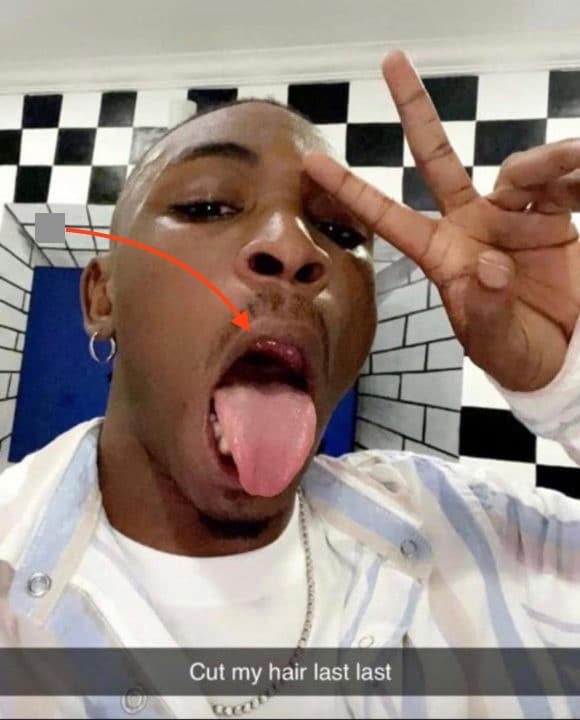 Mayorkun recounts how a fan broke his tooth on stage
