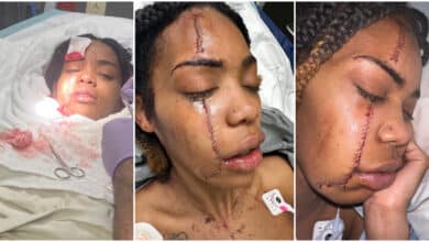 "It could've been an RIP post" - Lady stuns many as she miraculously survives after being stabbed 6 times in face and body