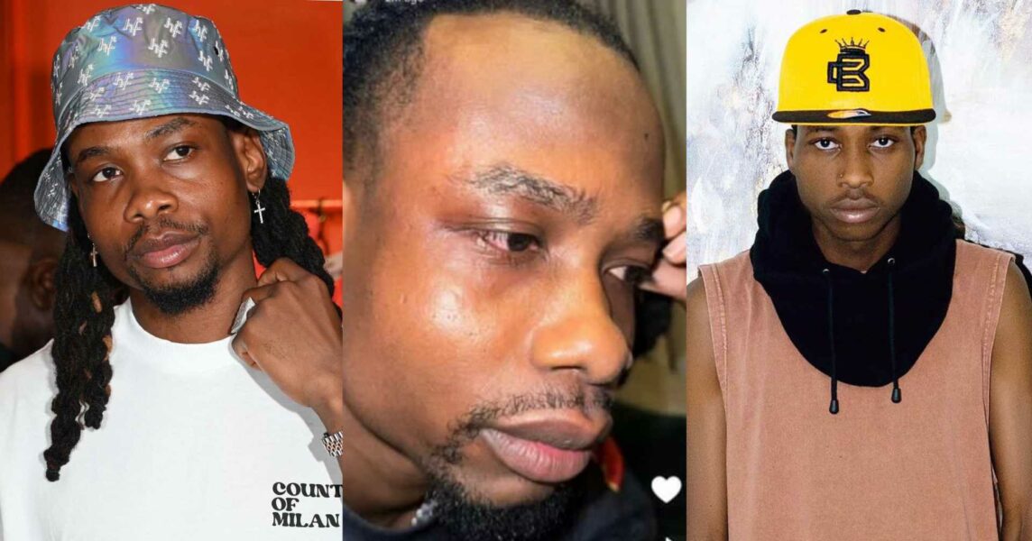 Lil frosh yhemolee slapped slap