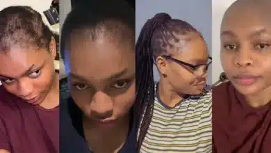 Lady goes bald after making knotless braids that cut off her front hair