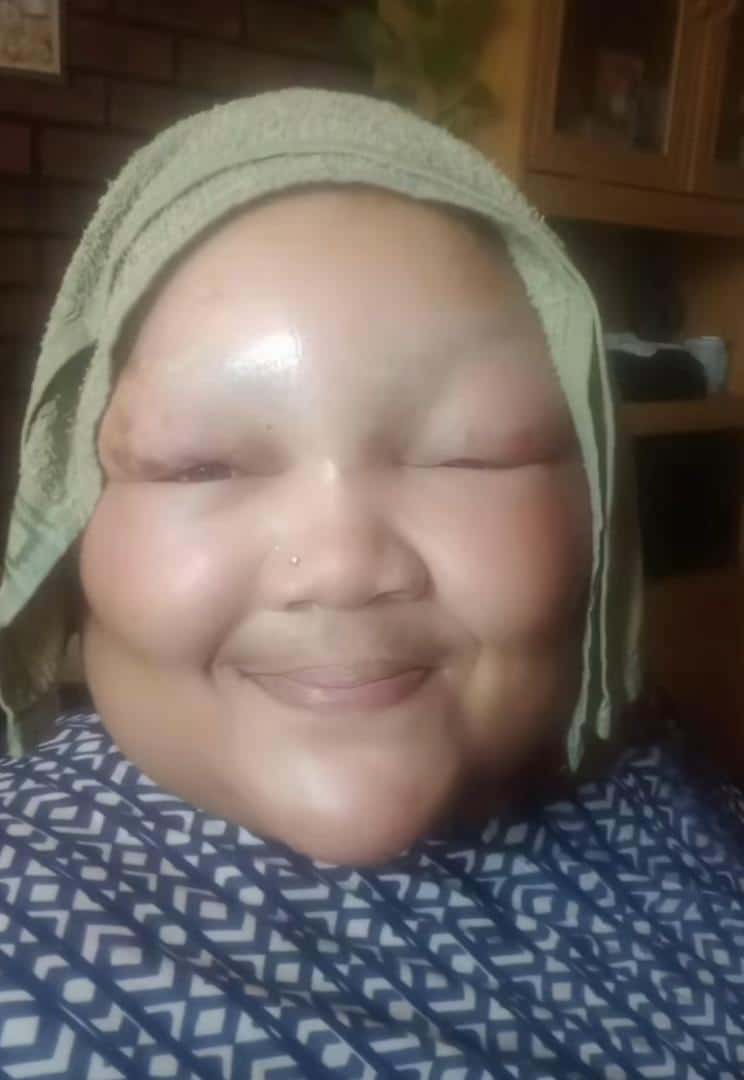 Woman shares aftereffect of bleaching her hair