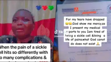 sickle cell patient sickler condition