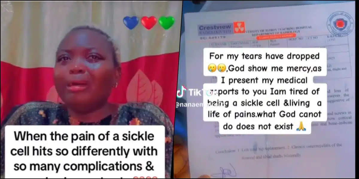 sickle cell patient sickler condition